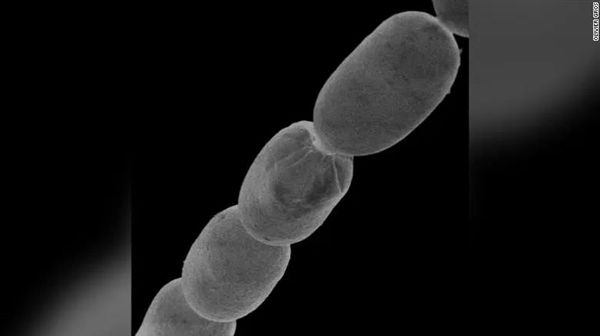 人家细菌肉眼都看不见 它却能长到2厘米长