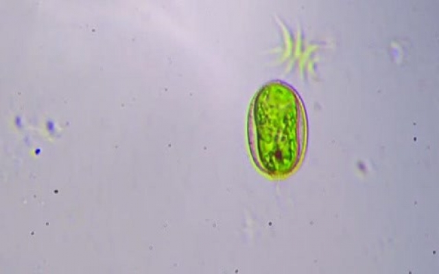 显微镜放大1000倍——微生物的生活