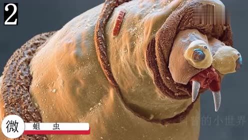 从未见过，但如此可怕！显微镜下的微观世界！
